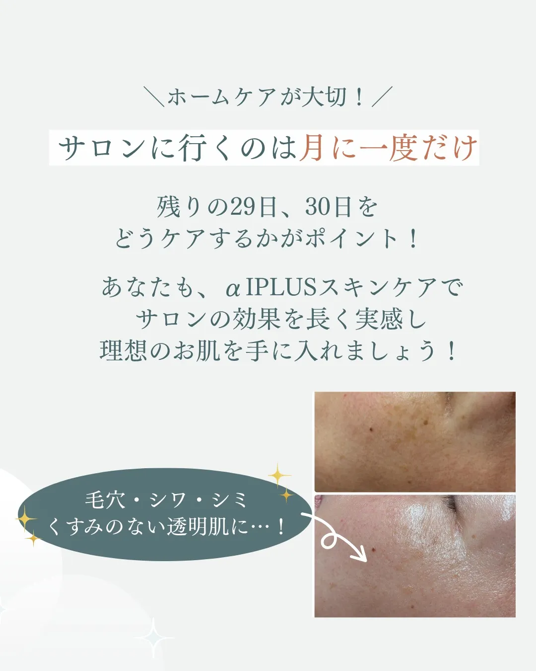 ホームケアでαIPLUSの効果を