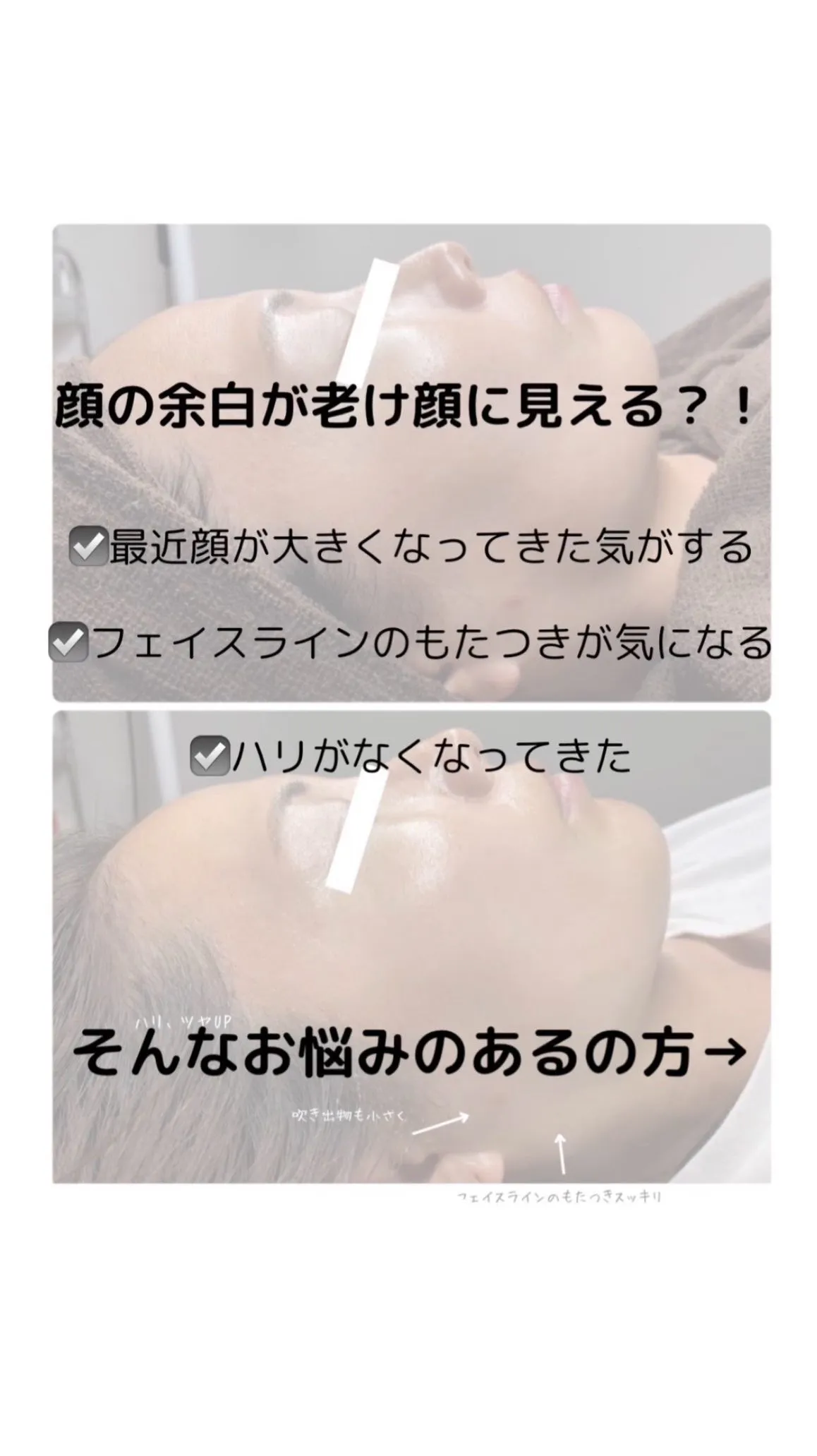 老け顔は顔の余白から！！