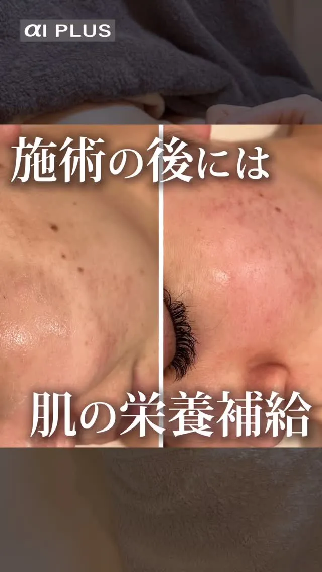 「最近、肌の元気がなくなってきたな…」と感じていませんか？ 